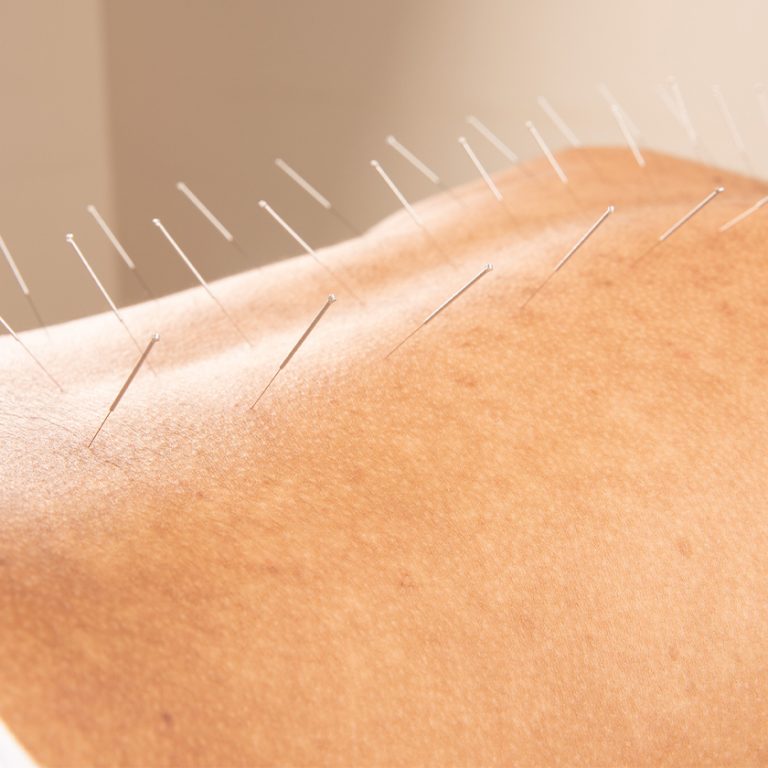 Naturopathy for Holistic Wellness